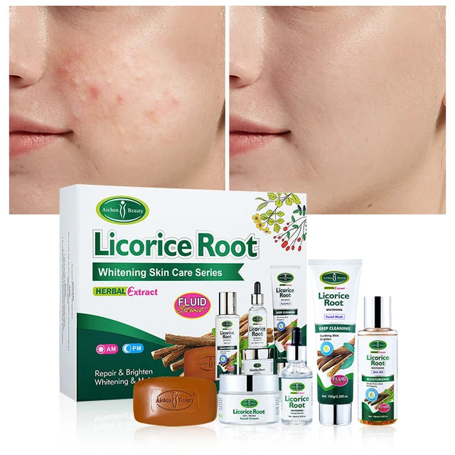 5pcs Licorice Root Face Skincare Set Anti-freckle Whitening Serum Fade Acne Marks Moisturizing Soap Cream Essence Oil Kit